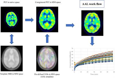 The Evaluation of Dynamic FDG-PET for Detecting Epileptic Foci and Analyzing Reduced Glucose Phosphorylation in Refractory Epilepsy